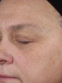 Before using Mary Kay Clinical Solutions Retinol 0.3